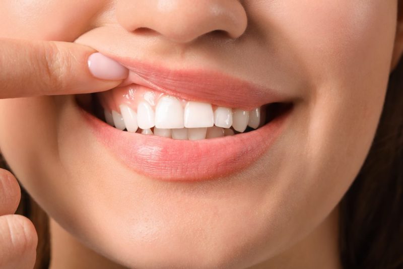 Which toothpaste do dentists actually recommend?